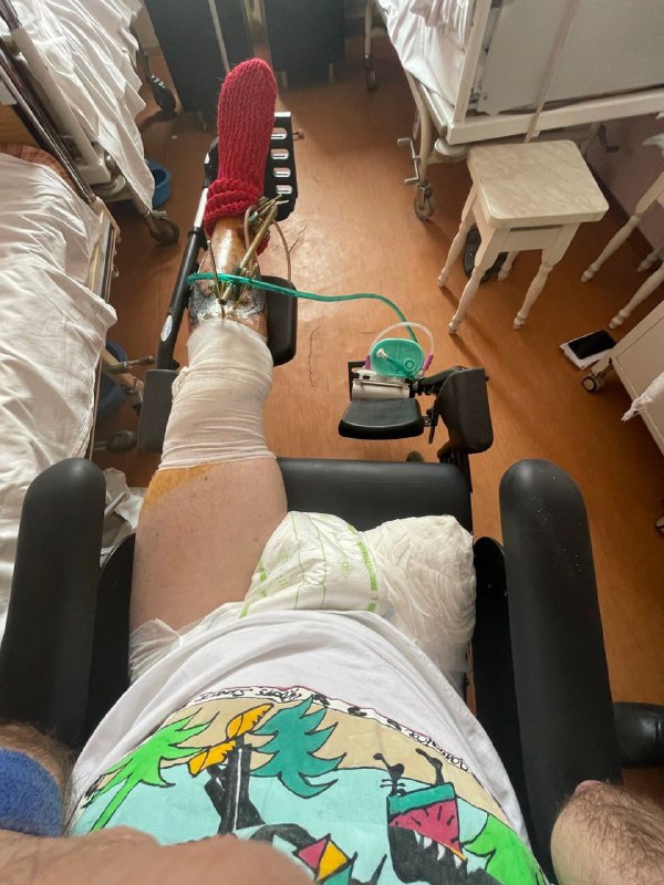 🇨🇿Český žoldák, který dříve utrpěl vážná zranění na Ukrajině, přišel o nohu. D...