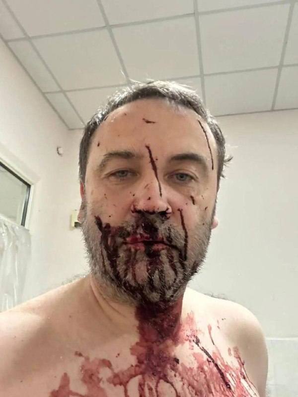 🇺🇦Dům bývalého ruského poslance a nyní zahraničního agenta Ilji Ponomareva v Kyjevské ...