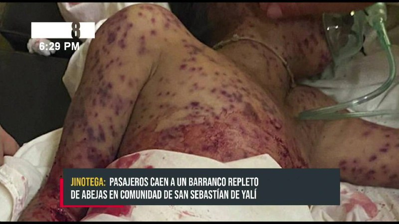 Horor z Nikaraguy: pasažéři autobusu se dostali k nehodě, kvůli které je k smrti ukously včel...
