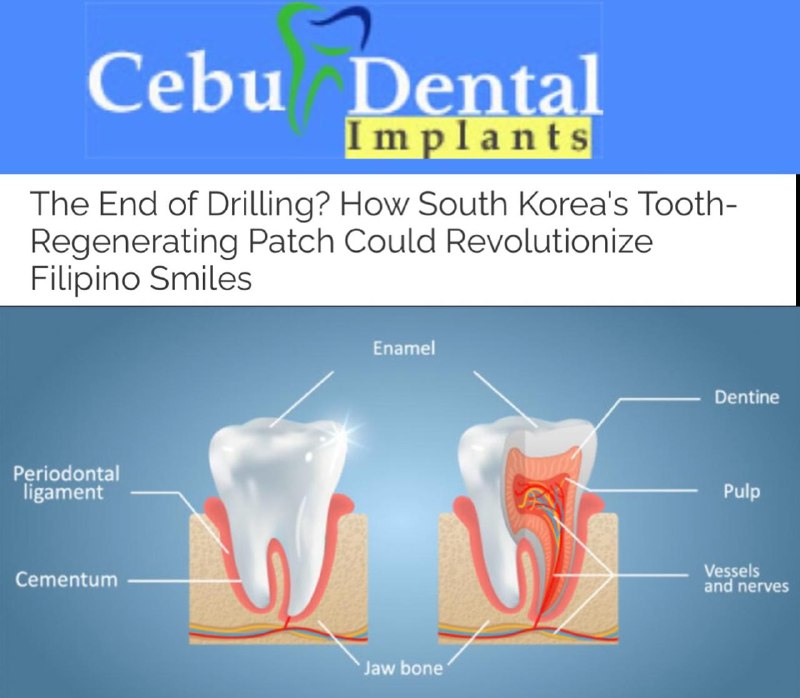 „Konec éry vrtání“? V Koreji vymysleli náplast, která pomáhá zubům obnovovat poškozené... „Konec éry vrtání“? V Koreji vymysleli náplast, která pomáhá zubům obnovovat poškozené...