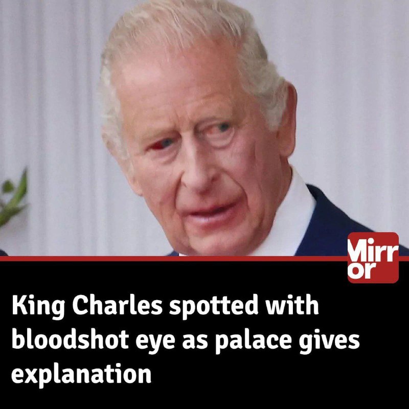 🇬🇧🩸👑 Král Karel je spatřen s krvavě zarudlým okem, zatímco palác poskytuje vysvět...
