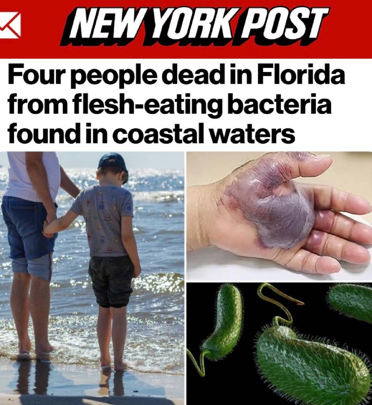 Na Floridě zemřeli čtyři lidé na bakterii Vibrio vulnificus, která "požírá maso"....