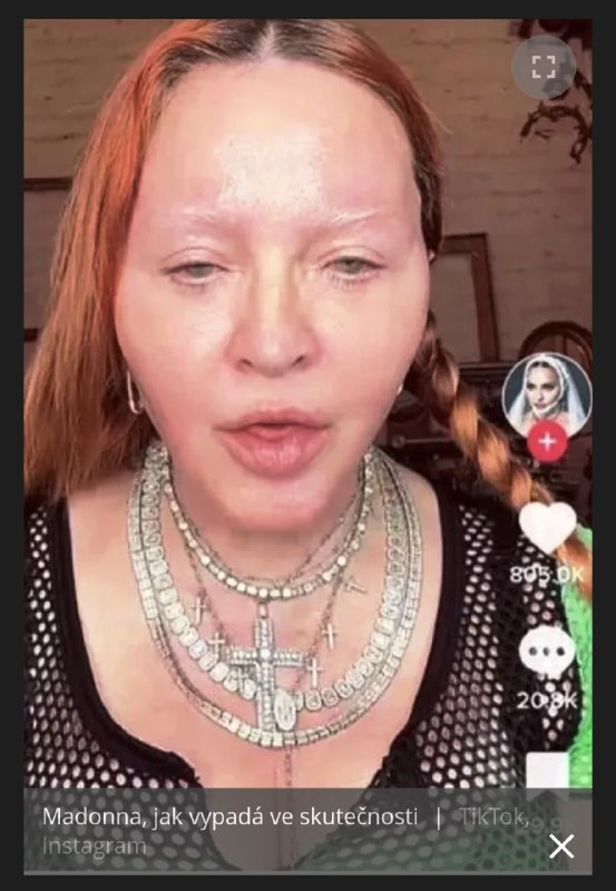 🇺🇸Na TikToku se objevilo video Madonny. Její zjev fanoušky bez přehánění vyděsil: Otekl...