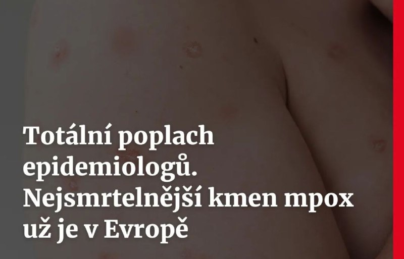 Totální poplach epidemiologů.Nejsmrtelnější kmen mpox už je v Evropě!Nejnebezpečnějš?... Totální poplach epidemiologů.Nejsmrtelnější kmen mpox už je v Evropě!Nejnebezpečnějš?...