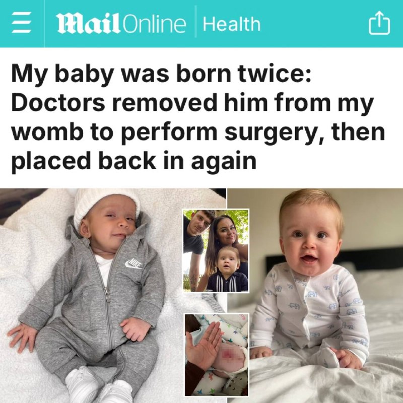 V Británii žena porodila totéž dítě dvakrátNa začátku těhotenství se matka dozvěděla, ?...