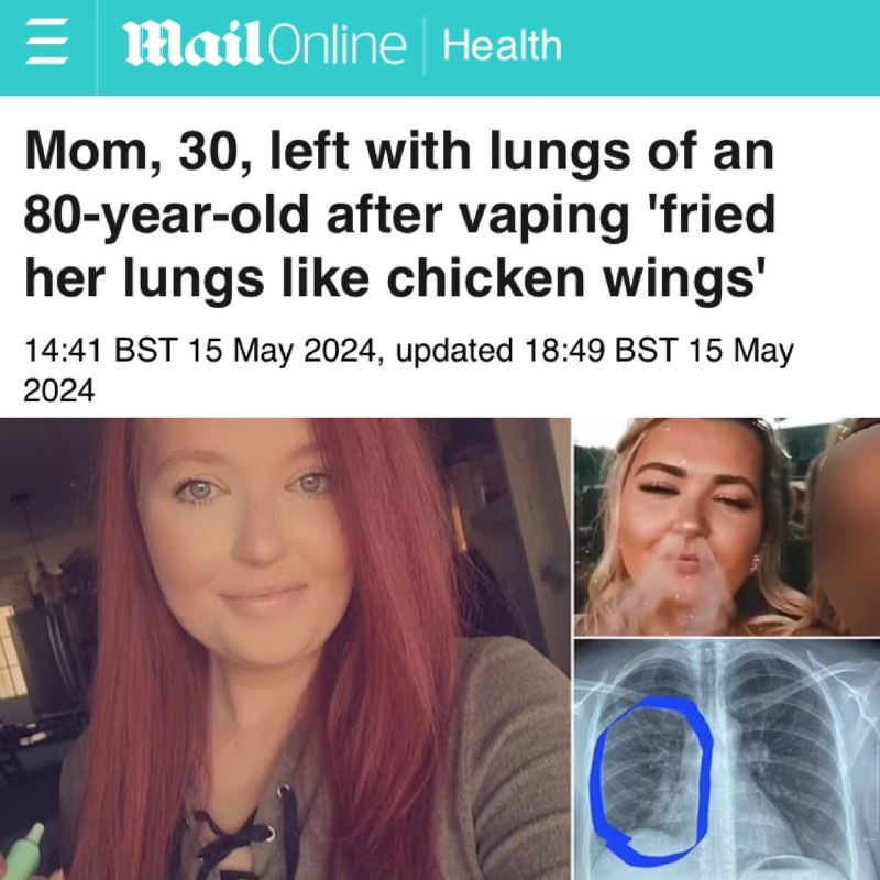 Vaping přivedl plíce 30leté dívky do stavu 80letých kuřáků, médiaDívka vapovala něco mál...