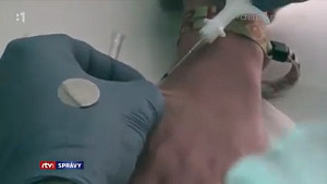 2/2 Co musíte vědět o čipování pod kůži. Od psa přes člověka po kyborga. Doba transhumanismu je tu!