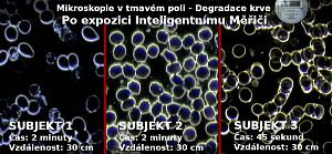Analýza živé krve - pozorovatelné účinky radiace RF a MW u Inteligentních Měřičů