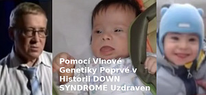 Účinná Léčba Downova Syndromu s Vlnovou Genetikou
